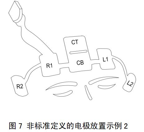 一次性使用腦電電極注冊審查指導(dǎo)原則（2022年第35號）(圖6)